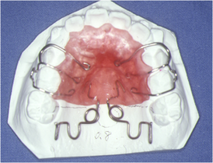 非抜歯-2